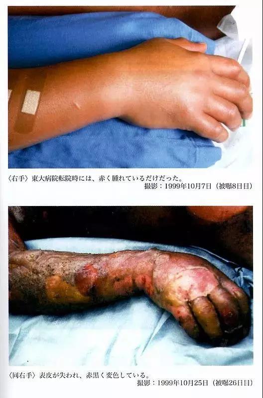 �¹ʺ�8�죨�ϣ���26�죨�£������ֶԱ�ͼ